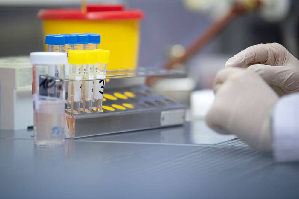  A woman shows a test for the new 2019-nCov virus during a press tour in a laboratory of the State Health Office