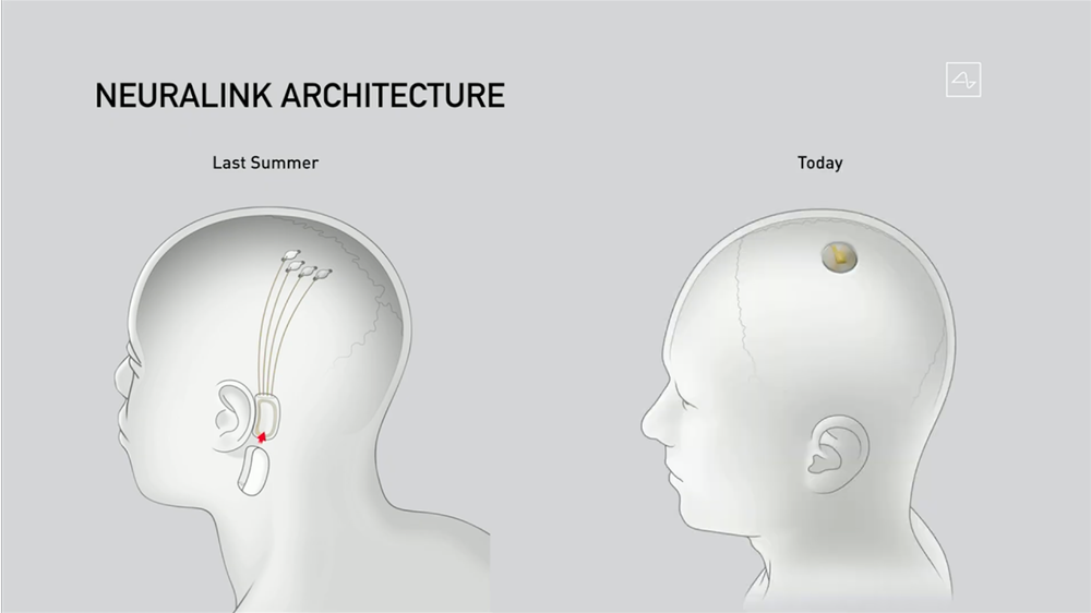 Neuralink slide