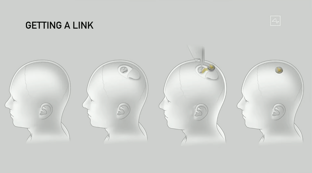 Neuralink slide (for "getting a link")